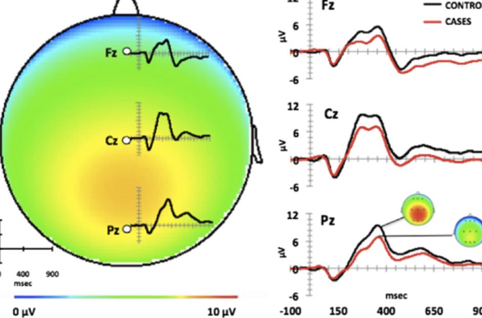 作为脑机接口产品经理，我用的3个BCI技术